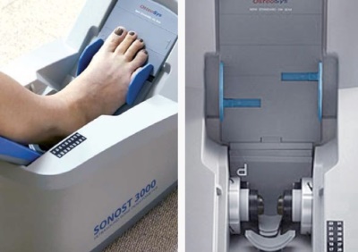 OsteoSys SONOST 3000