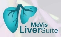 MeVis Liver Suite
